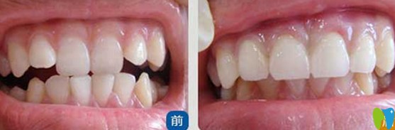 天津美萊口腔高志永怎么樣？真人案例及反饋來(lái)嘍