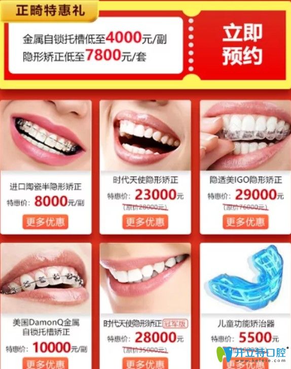 廣大看口腔牙齒矯正價格表