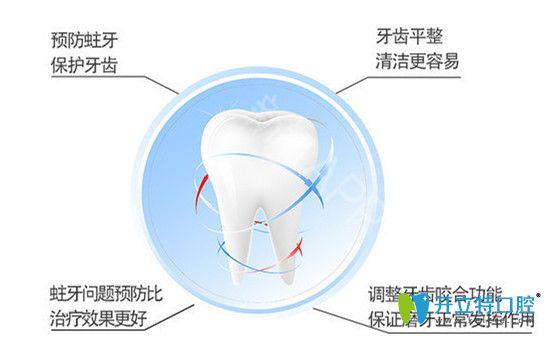 為什么要做窩溝封閉
