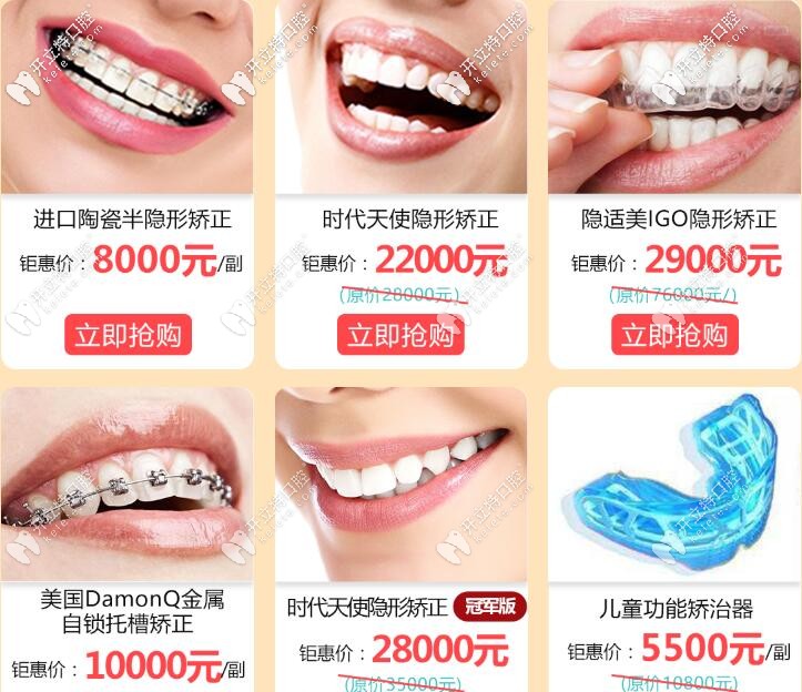 廣州成人牙齒矯正活動(dòng)價(jià)格表