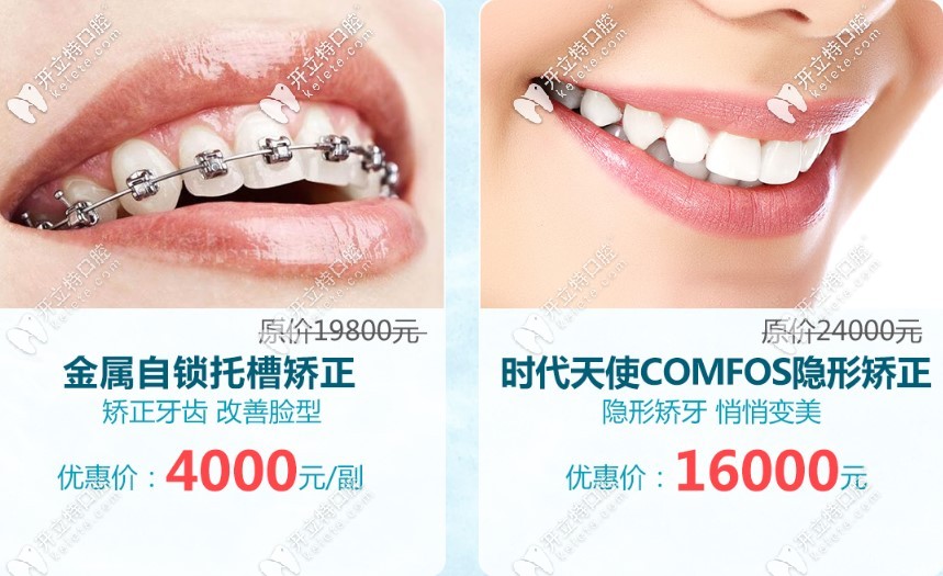 廣州市牙套價(jià)格表請(qǐng)收藏,金屬自鎖+隱形矯正的費(fèi)用值得一觀