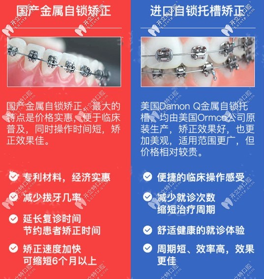 國(guó)產(chǎn)與進(jìn)口金屬自鎖矯正區(qū)別