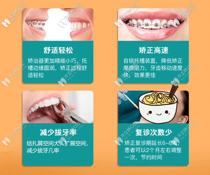 金屬自鎖牙套的優(yōu)點