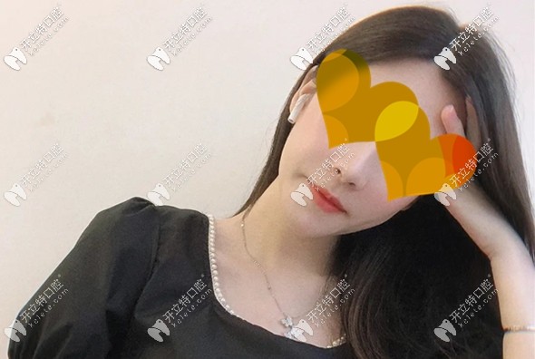 吳小姐做完正頜術(shù)后3個月效果圖